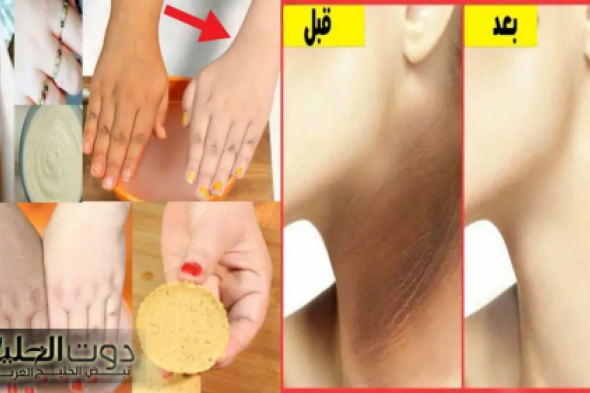 قنبلة التبييض.. كريم لبان الذكر والفازلين المبهر لتبييض وشد الوجه وإزالة التجاعيد والبقع السوداء من أول استعمال