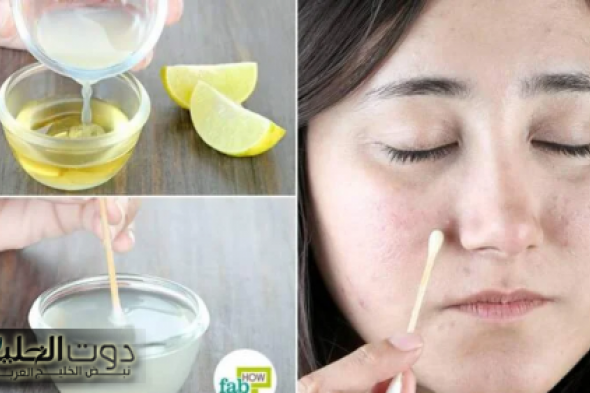 "مش هتعرفي نفسك" ضعي هذا المكون على بشرتك وأحصلي على بشره بيضاء كالثلج