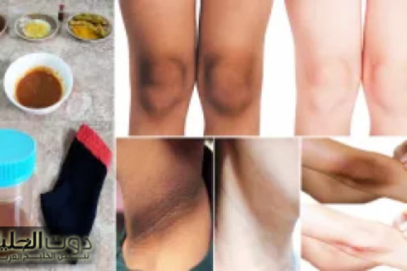 مقشر القهوة الجبار لتقشير الخلايا الميته والبقع الداكنة في الركب والأكواع لن تصدقي النتيجة مذهله