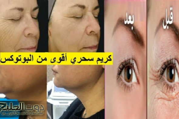 "منتجات البوتوكس والفيلر هتبقا برخص التراب لما سرها ينكشف!!".. معجزة الخميرة لنفخ الخدود وتسمين الوجه وتفتيح لون البشرة من اول مرة!!