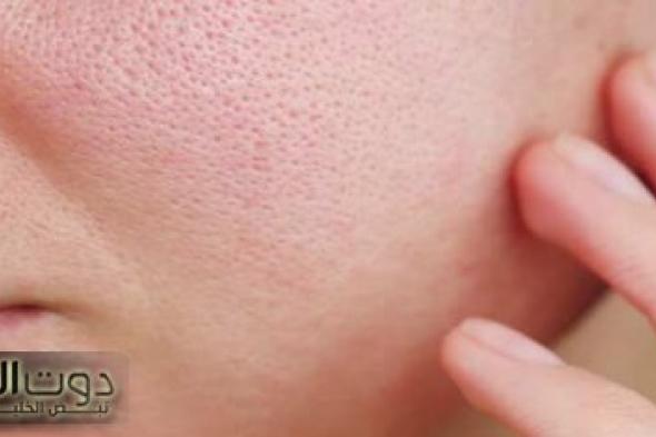 غلق مسام الوجه بطرق طبيعية بماسكات فعالة سهلة وسريعة التحضير منزليًا