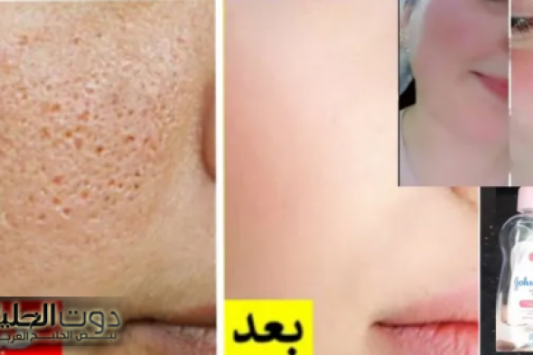 "مطلعش للاطفال بس"...إستخدمي زيت جونسون بهذة الطريقة وحلى أكبر مشكلة بتعاني منها