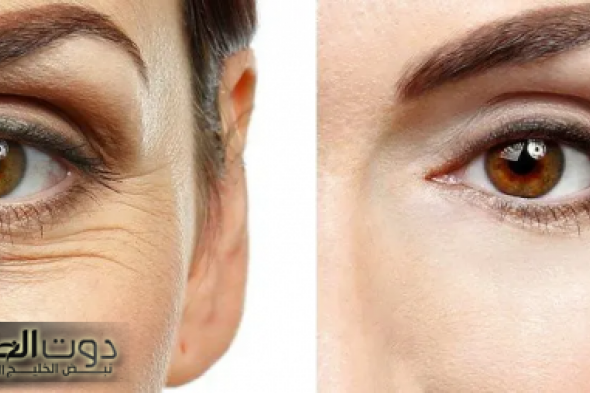 القناع السحري للتخلص من تجاعيد البشرة وعلامات التقدم في السن بوتوكس طبيعي