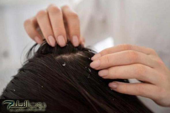 من أجل فروة صحية خالية من القشرة.. وصفة الخردل لشعر أكثر نعومة