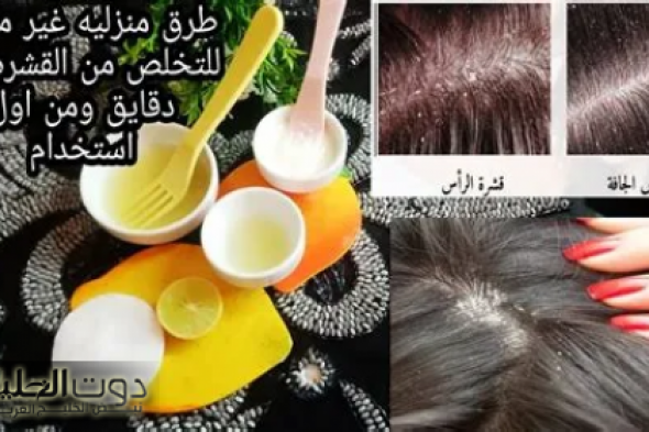 "انسى مشكلة قشرة الشعر والتساقط خالص".. طرق فعالة لعلاج قشرة الشعر وتساقطه بوصفات سهله وسريعة!!