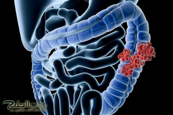 "كنز ثمين لا يقدر بثمن في كل بيت".. عشبة بسيطة تنظف القولون من البراز المتحجر والفضلات في دقائق معدودة دون الحاجة للطبيب!!