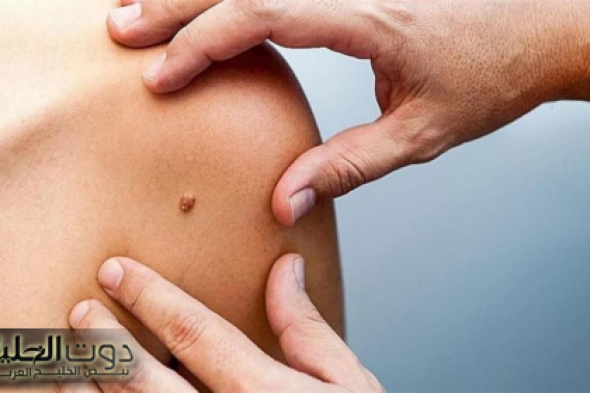 إحذروو .. علامات إذا ظهرت على بشرتك فأعلم أنك مصاب بالسرطان وعليك زيارة الطبيب فورا .. خلي بالك