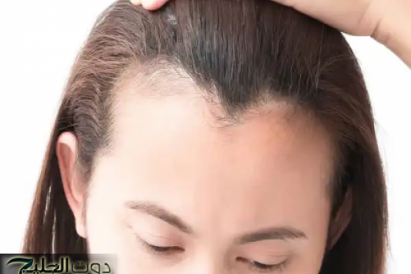 وصفة الإنبات الصاروخية لتكثيف وملئ فراغات الشعر ومقدمة الرأس بسرعة البرق لن تصدقي النتيجة