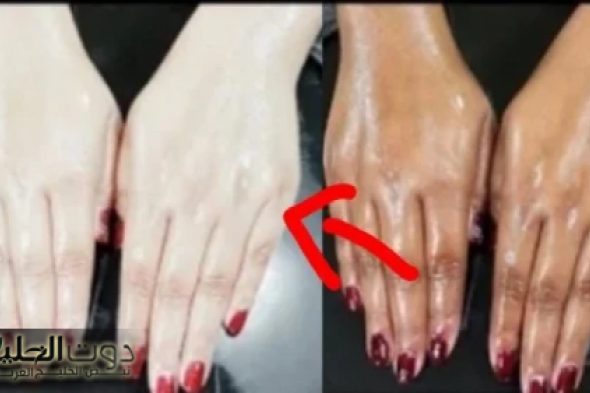 "أقوى وصفة سحرية".. لتبيض الوجه واليدين والقدمين وإزالة سواد الشمس والقضاء على حب الشباب والهالات السوداء وتوحيد لون الجسم!