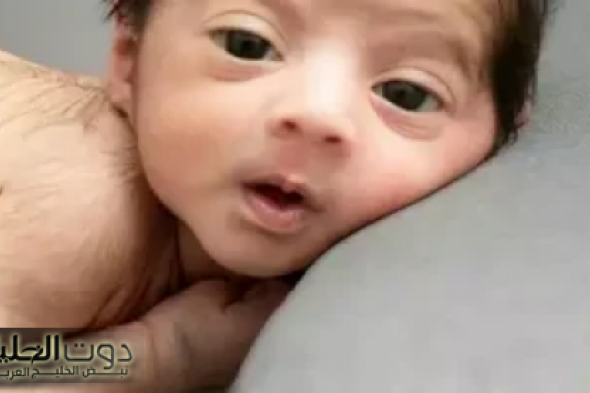 "حالة طبيعية ولا مرض"...كثافة الشعر على جسم المولود | لماذا يولد بعض الأطفال بشعر كثيف؟