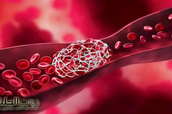 مشروبات تحميك من خطر الإصابة بالجلطات المفاجئة