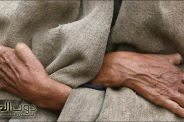 مرض الجذام.. تعرف على أعراضه وأنواعه وطرق الوقاية والعلاج من وزارة الصحة