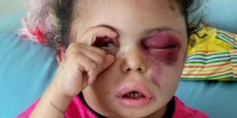 أخبار اليمن : بعد 4100 يوم.. ماذا فعل العدوان باليمن؟